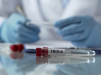 Ebola aşısı insan denemeleri yakında Birleşik Krallık'ta başlayacak